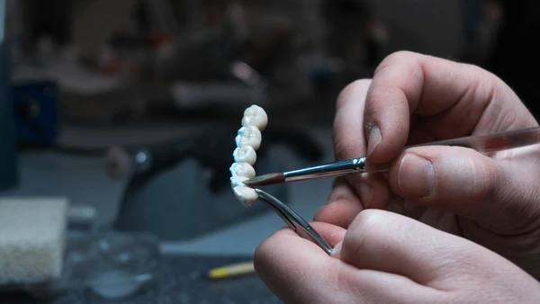 dental bridges near you