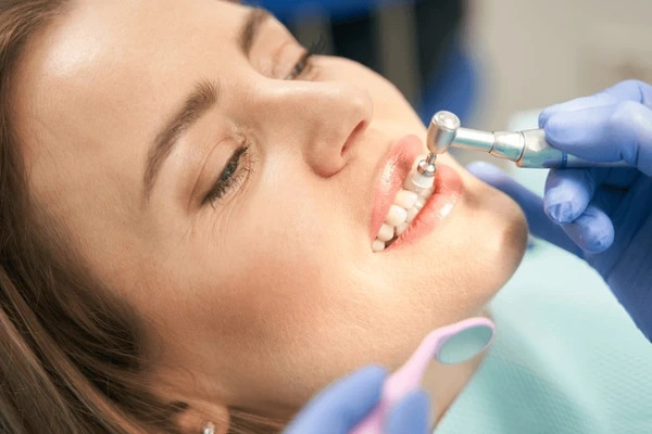 dental cleanings in walnut grove, bc