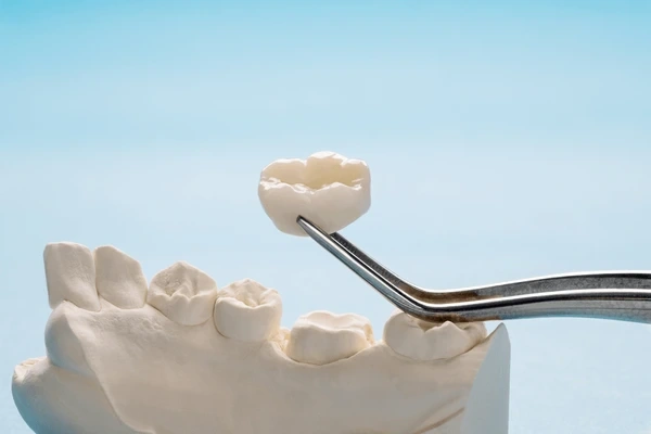 dental crowns near you