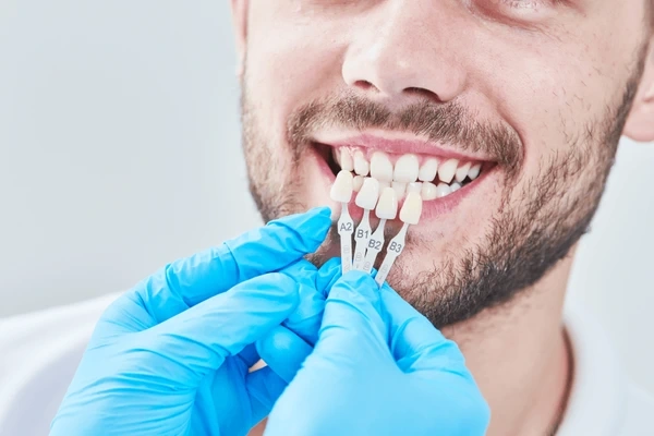 tooth-coloured restorations in walnut grove, bc