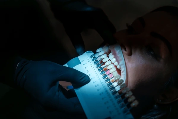 tooth-coloured restorations near you