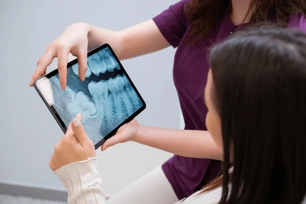 tooth extractions in walnut grove, bc